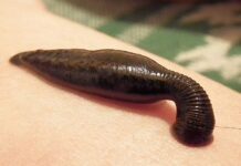 샨주 거머리 수요 증가 거머리