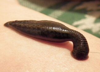 샨주 거머리 수요 증가 거머리